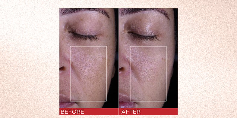 In-Article-best-anti-aging-cream_1